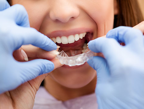 Over orthodontie